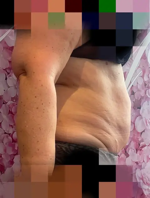 Photo après traitement