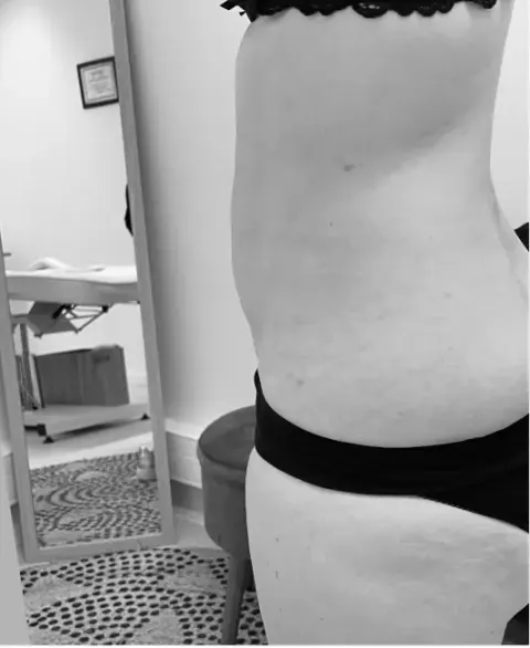 Photo après